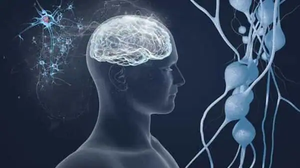 alzheimer