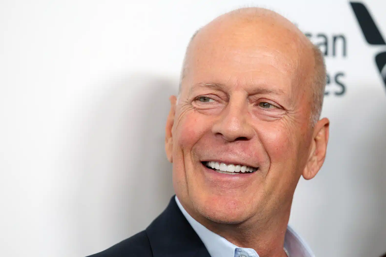 bruce willis igeia