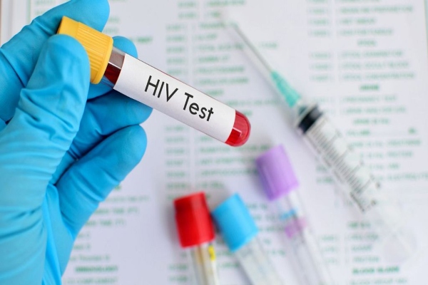 hiv 1