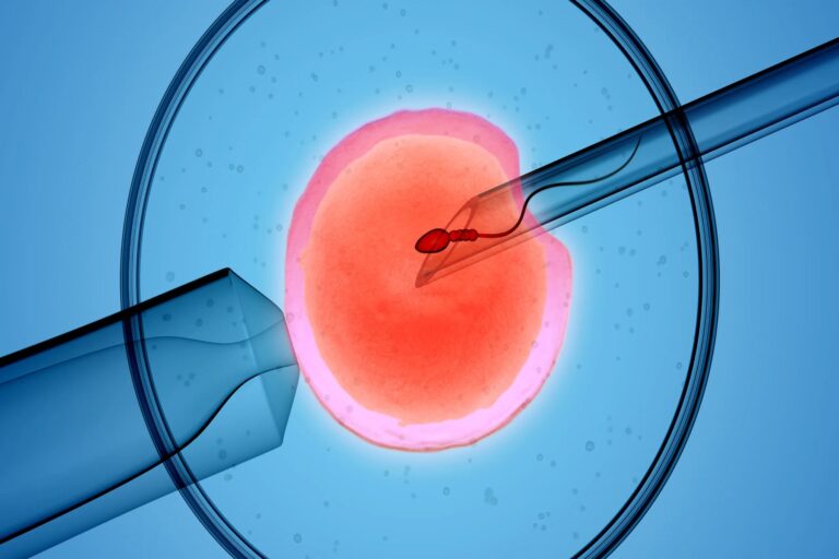 Tips εγκυμοσύνη: Συμβουλές εγκυμοσύνης για γυναίκες που υποβάλλονται σε εξωσωματική γονιμοποίηση