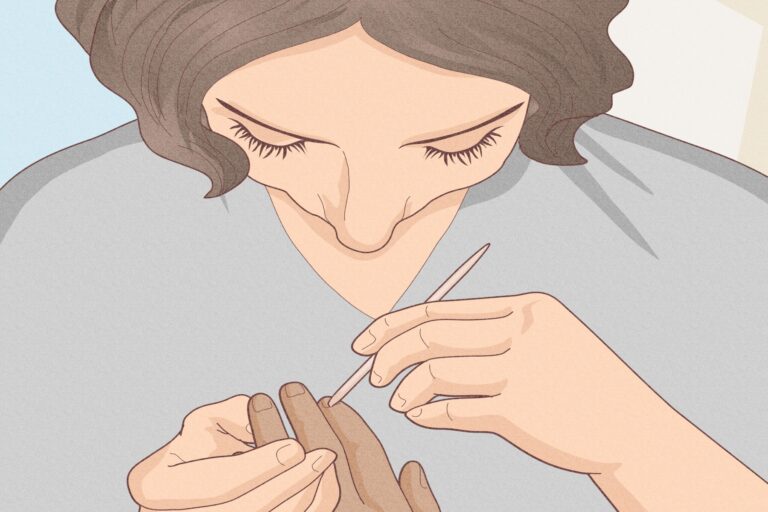 Δέρμα νύχια: Τι προκαλεί ξεφλούδισμα στο δέρμα γύρω από τα νύχια μας;