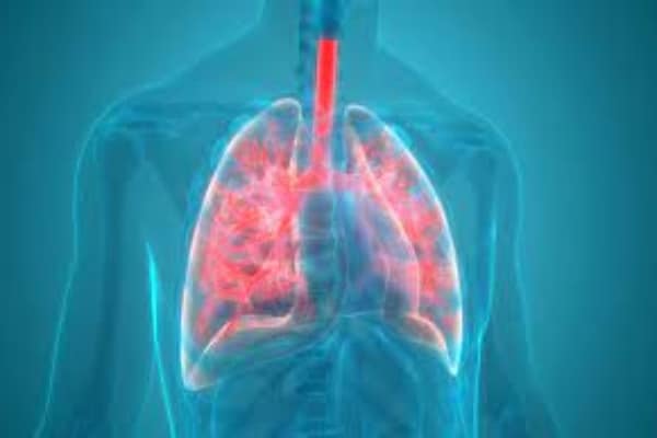 pneumonia 1