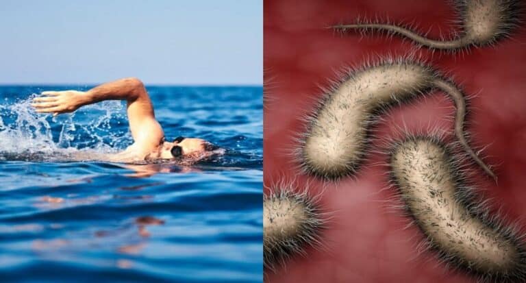 Βακτήριο Vibrio Vulnificus: Ανησυχία για αύξηση των λοιμώξεων λόγω των ακραίων καιρικών φαινομένων, επισημαίνει το CDC