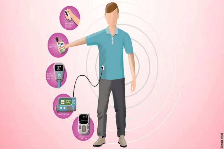 Τεχνολογία διαβήτης: Πώς η τεχνολογία έχει βελτιώσει την ποιότητα ζωής για τα άτομα με διαβήτη;
