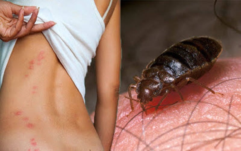 bed bugs bite