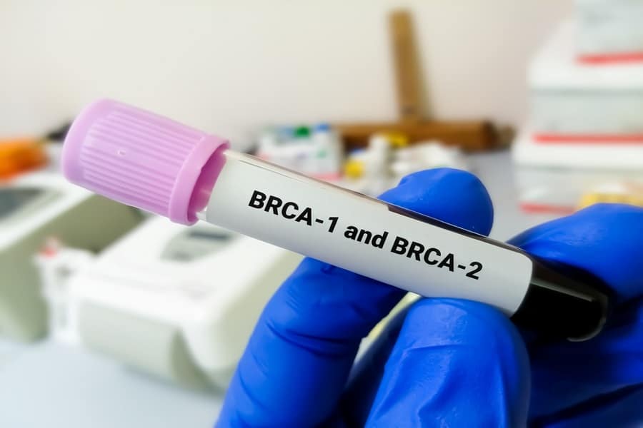 breast cancer genes brca