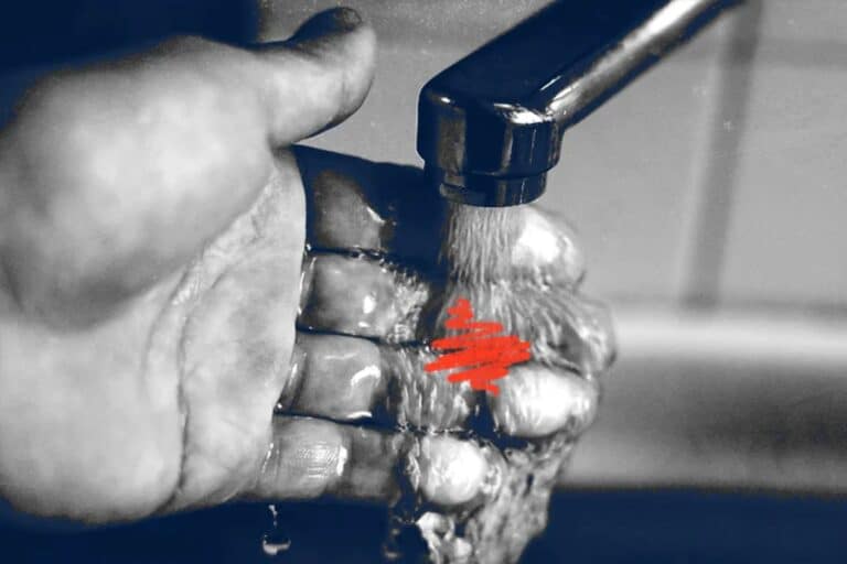 Κόψιμο κάψιμο: Χρησιμοποιώντας κοινές θεραπείες για τραυματισμούς στην κουζίνα