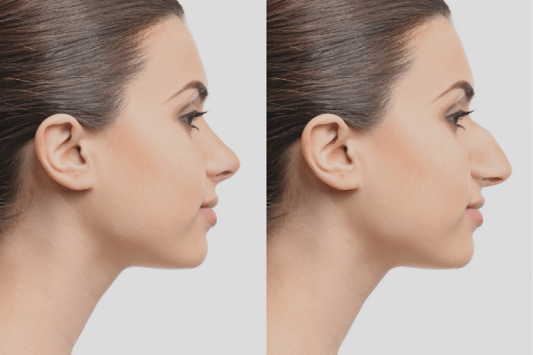 plastiki xeirourgiki e1697532722636