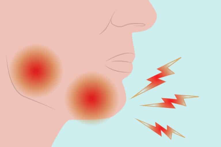 Πόνος γνάθου: Κοινές αιτίες πόνου στη γνάθο που πρέπει να δώσετε προσοχή