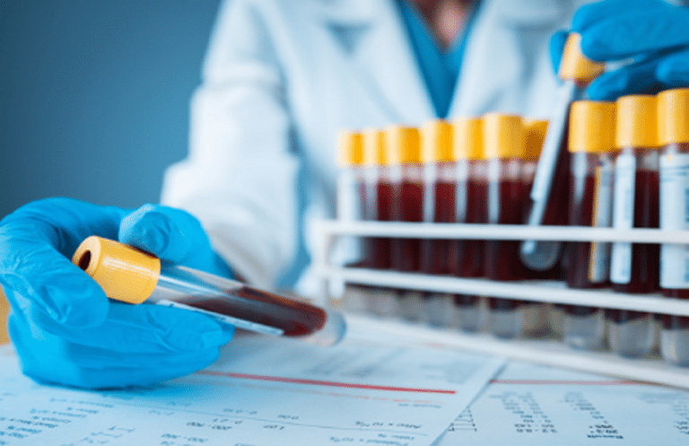 Νόσος του Crohn: Πρώτη ολοκληρωμένη οδηγία χρήσης βιοδεικτών για την παρακολούθηση της ασθένειας