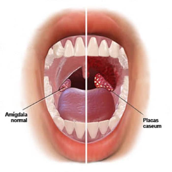mouth b