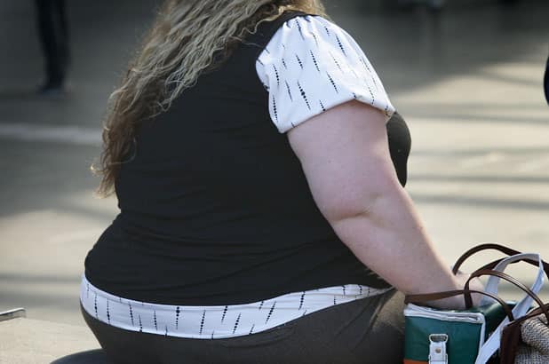 obesity a