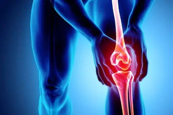 osteoarthritinta e1699252166682