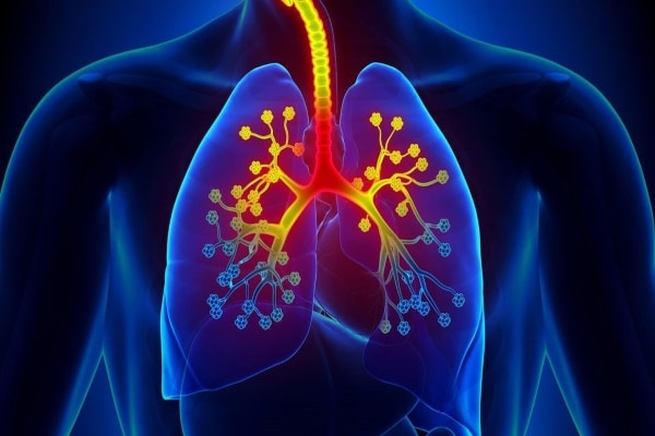 asthma 2