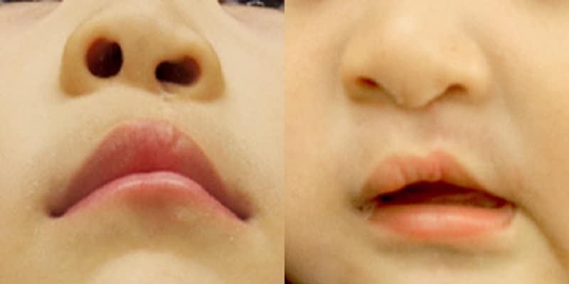 img treatment03 3