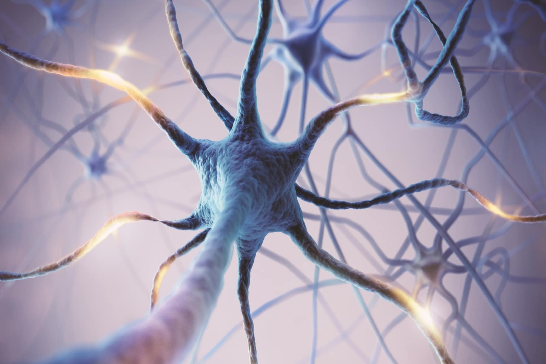 alzheimer