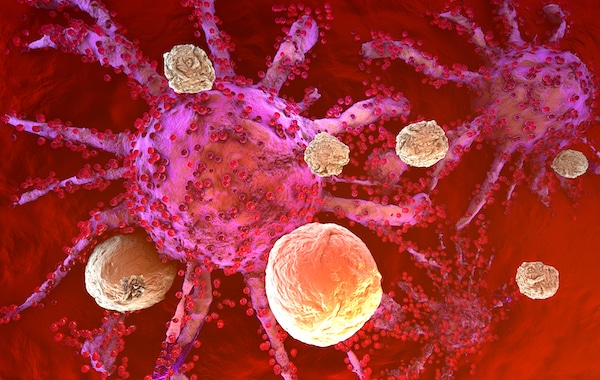 cancer 3