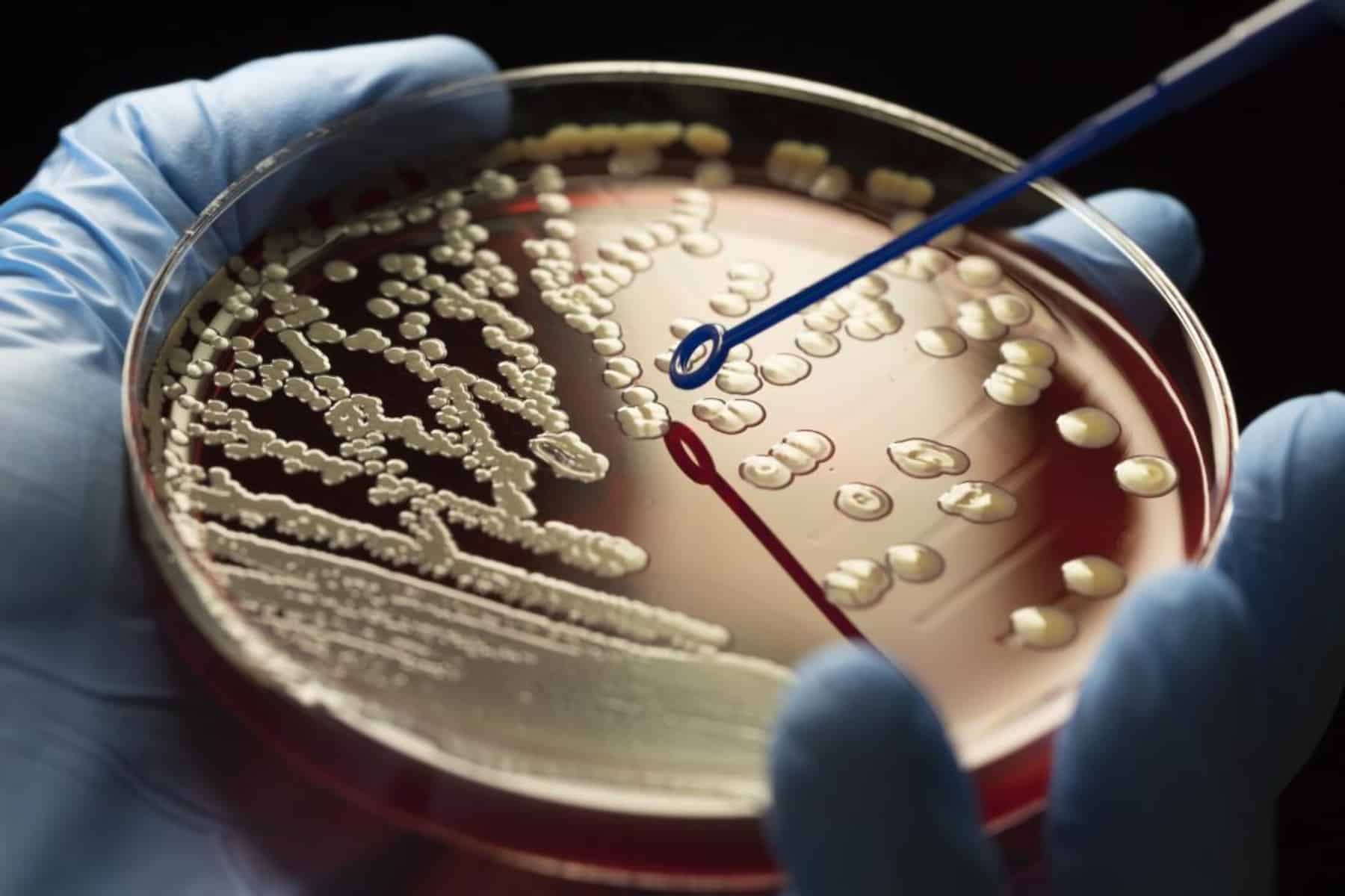 mrsa in petri dish