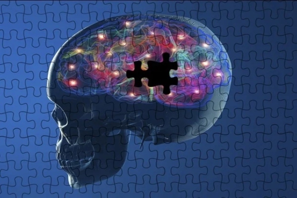neurones 1