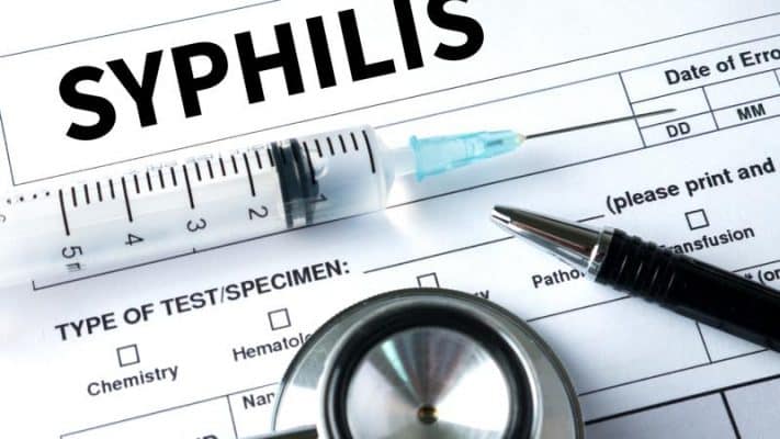 siphilis e1706688203933