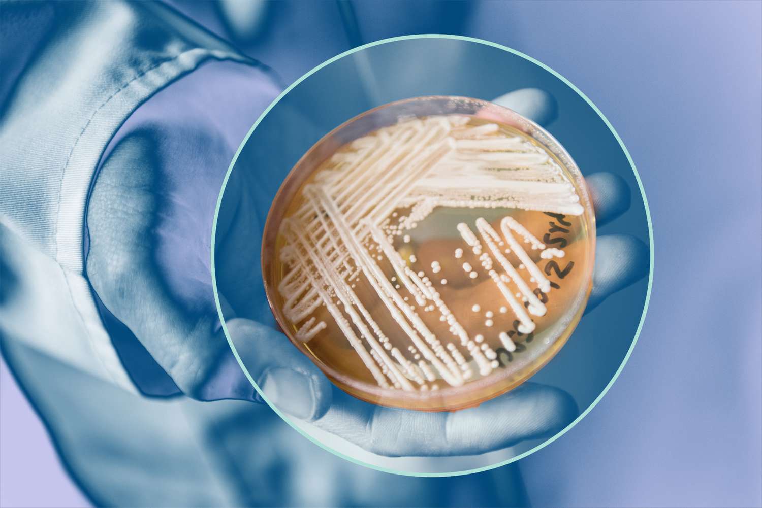candida auris