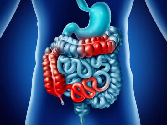 crohn e1707206133377