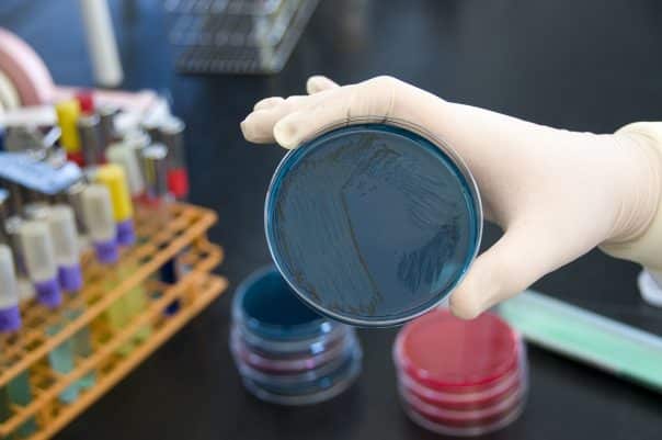 salmonella test fda public domain via wikimedia commons e1679935985638