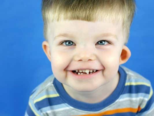 williams syndrome e1708934703280