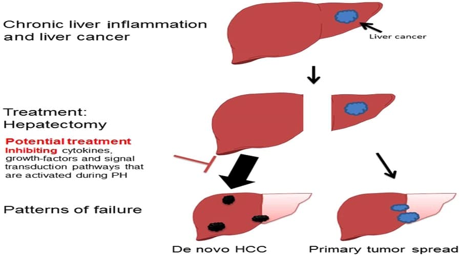 liver a
