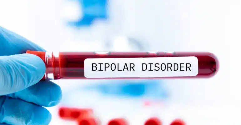 bipolar