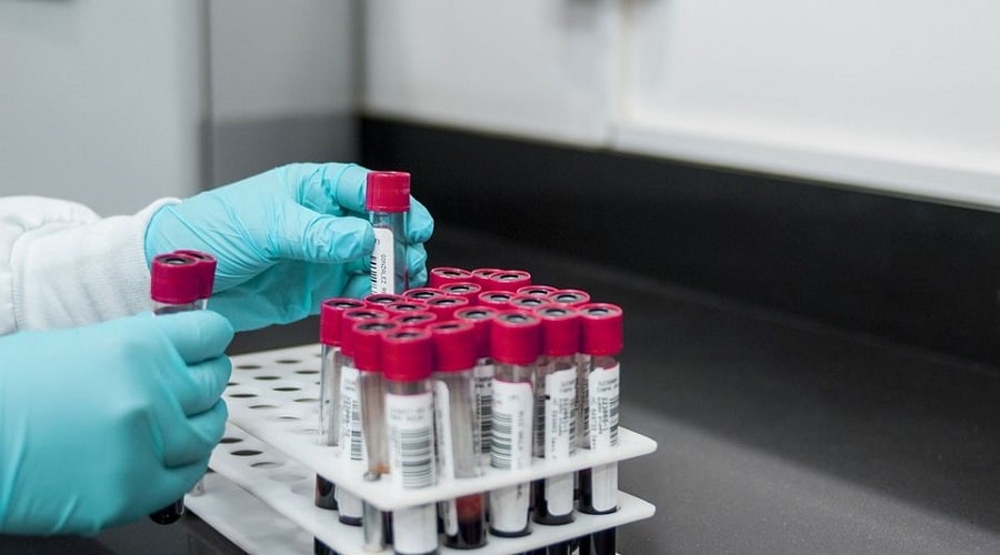 blood test a