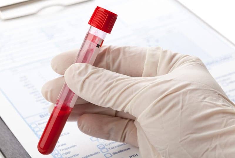 bloodtest
