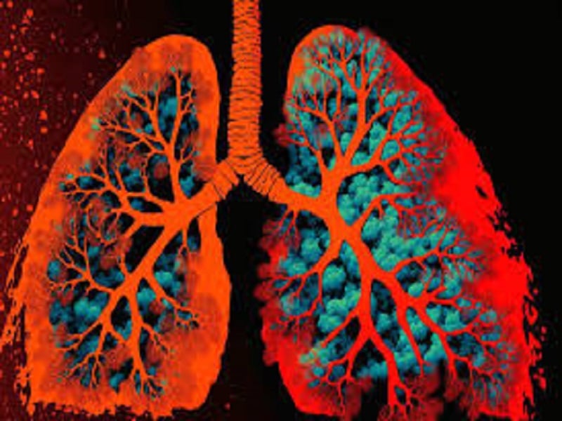 asthma 7