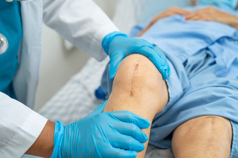 knee replacement complications