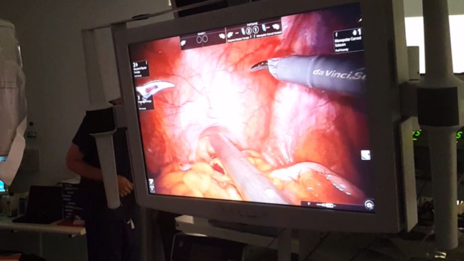 prostate cancer