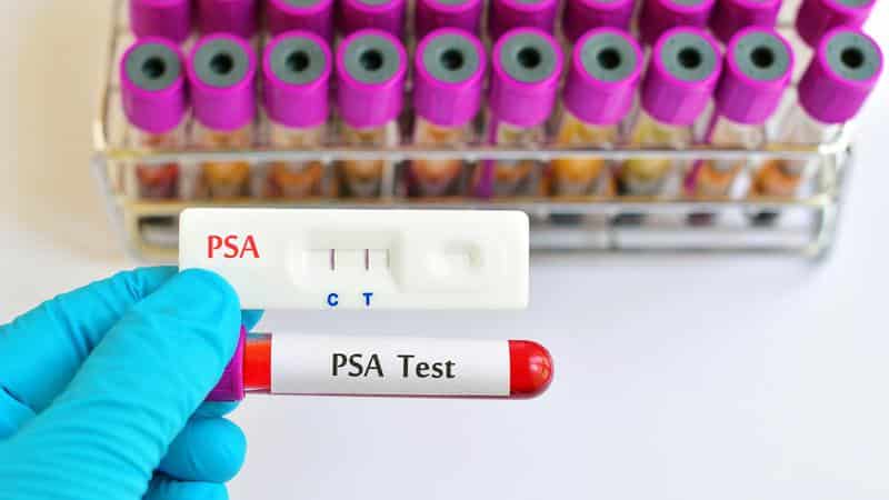 psa w 1