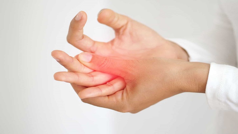 psoriasis a
