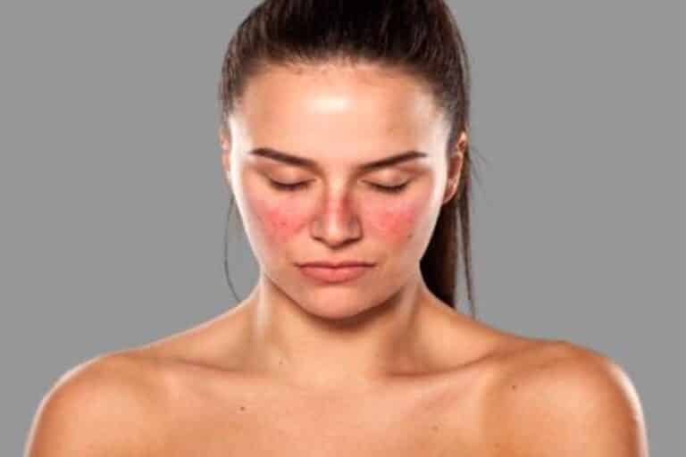 Ένας κοινός ιός ίσως «ξεκλειδώνει» τον λύκο