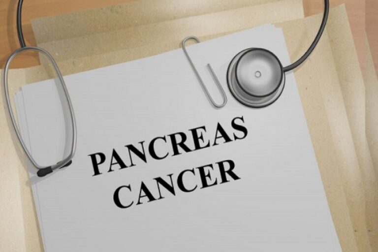Καρκίνος παγκρέατος: Ποια είναι η σημασία της παρεμπόδισης κολλαγόνου;