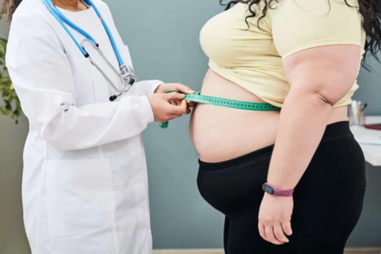 Παιδική παχυσαρκία: Ραγδαία αύξηση σε ένα κρίσιμο ζήτημα δημόσιας υγείας