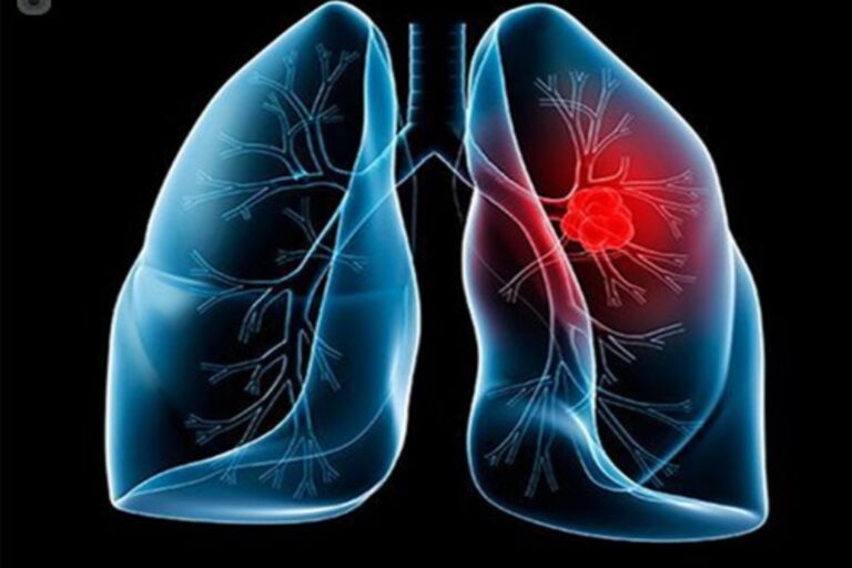 Τα κινητά στοιχεία DNA αποκαλύπτουν τον ρόλο τους στην εξέλιξη του καρκίνου