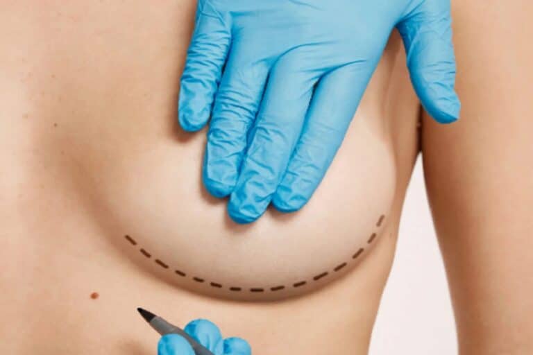 Προσθετική στήθους ή αφαίρεση: Τι πρέπει να γνωρίζετε