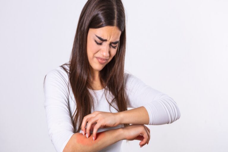 Κνησμός: Γιατί το ξύσιμο είναι τόσο ευχάριστο