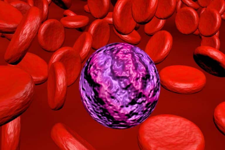 Λευχαιμία: Τα πρώτα ανησυχητικά συμπτώματα