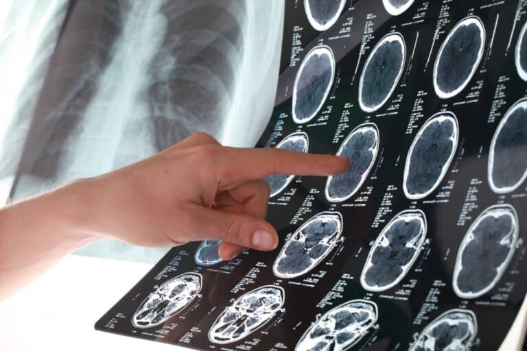 Εργαλείο AI βελτιώνει την ανίχνευση προβλημάτων χρωμοσωμάτων