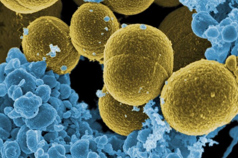 Enterococcus faecalis: Νέα μέθοδος αφοπλίζει τα υπερμικρόβια, θεραπεύει χρόνιες πληγές