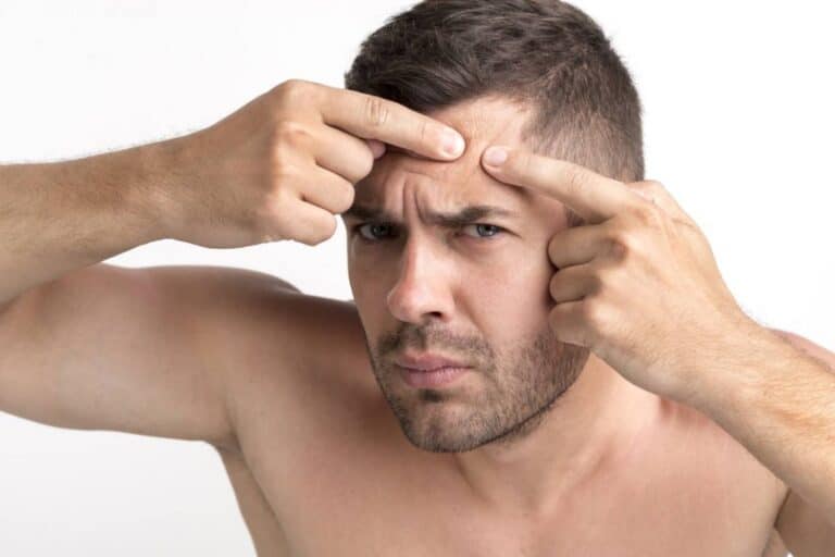 Λιπαρή επιδερμίδα: 5 κανόνες για να τη φροντίζεις σωστά