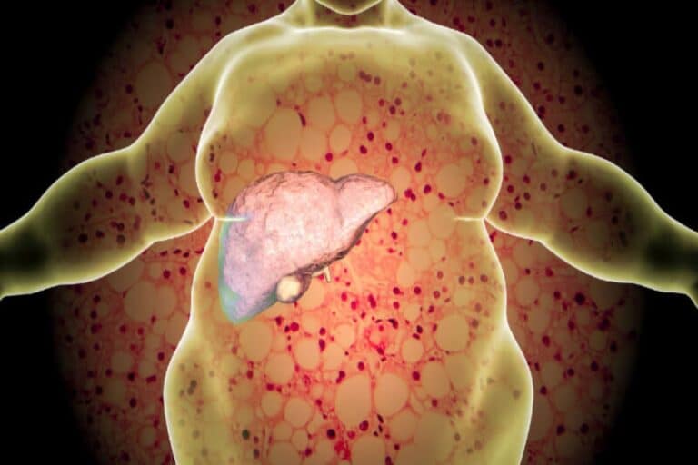 Υγιές συκώτι: Η σοβαρή νόσος που δεν έχει συμπτώματα