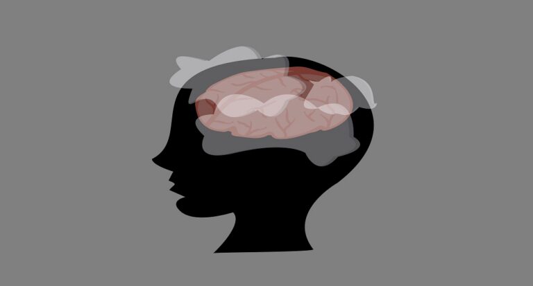 Brain fog μετά τα 50: Τι συμβαίνει στο μυαλό μας