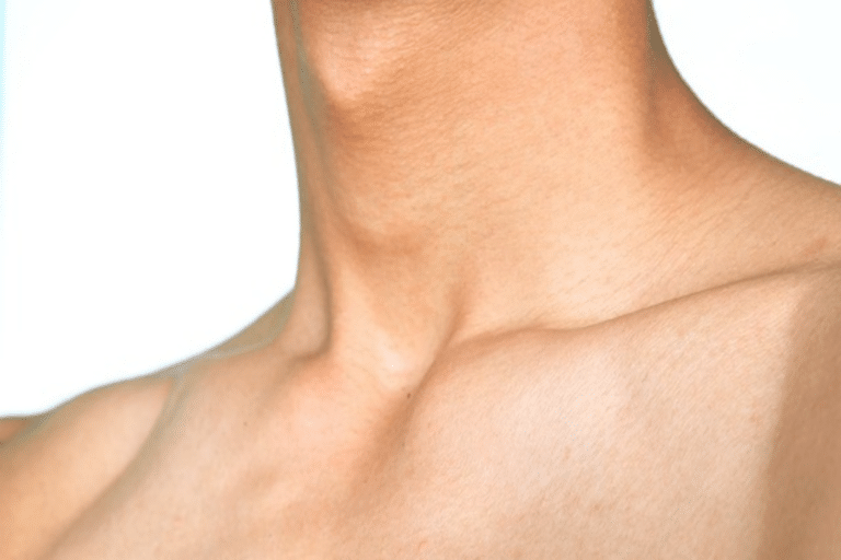 Καρκίνος του λάρυγγα: Μία πρωτοποριακή θεραπεία